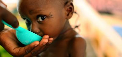 مردم کدام کشورها دچار سوء تغذیه هستند؟