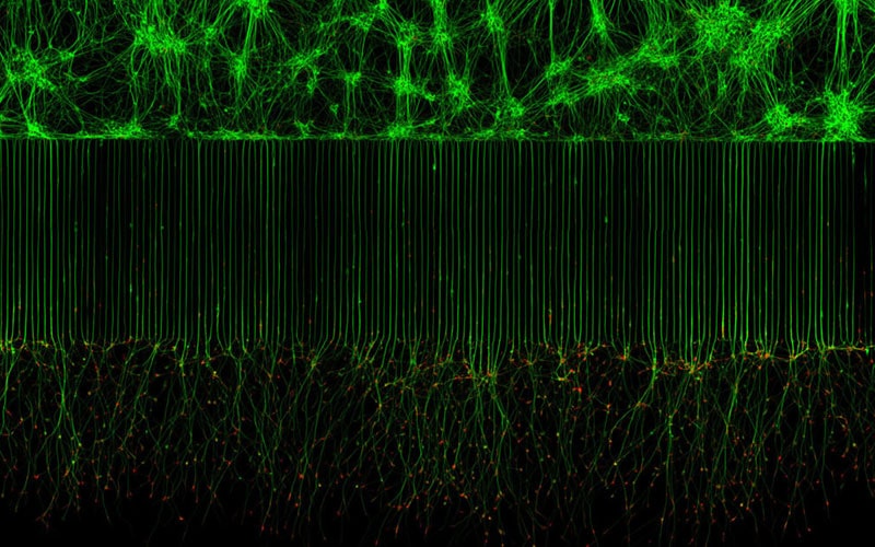 تصویر میکروسکوپی از رشد نورون‌های حرکتی