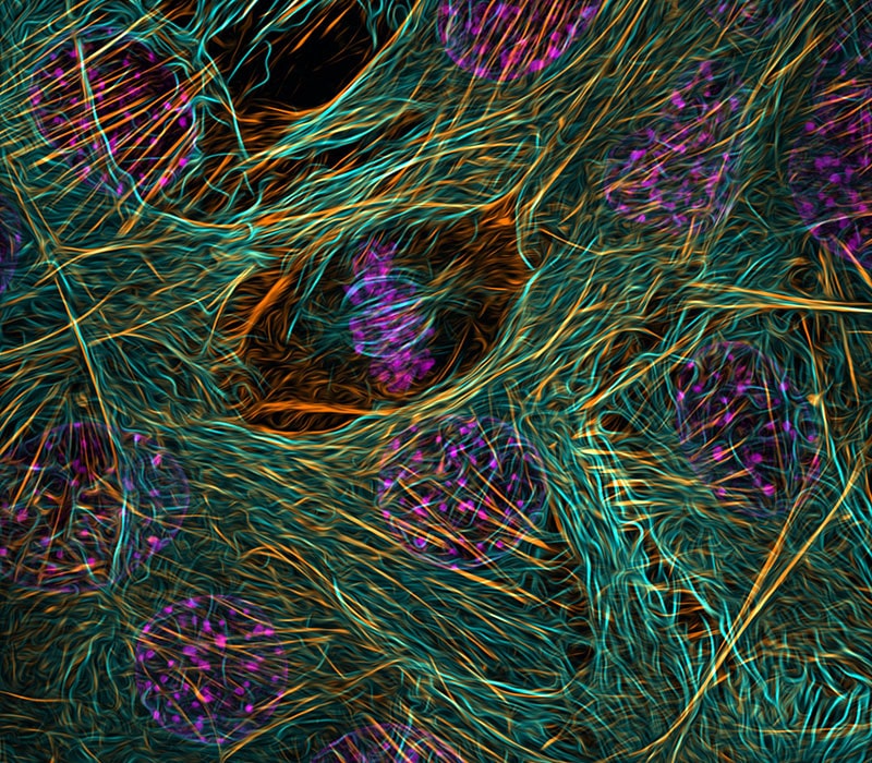تصویر میکروسکوپی از اسکلت سلولی یک جوانه ماهیچه