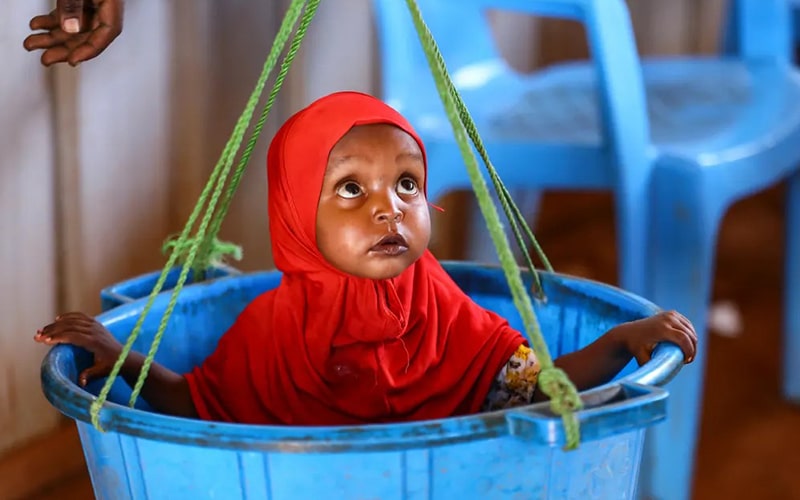 وزن کشی دختری در سومالی